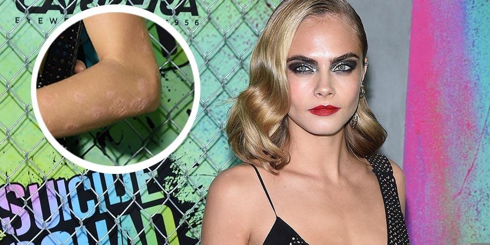 Кара Делевинь Горячие Фото Слив