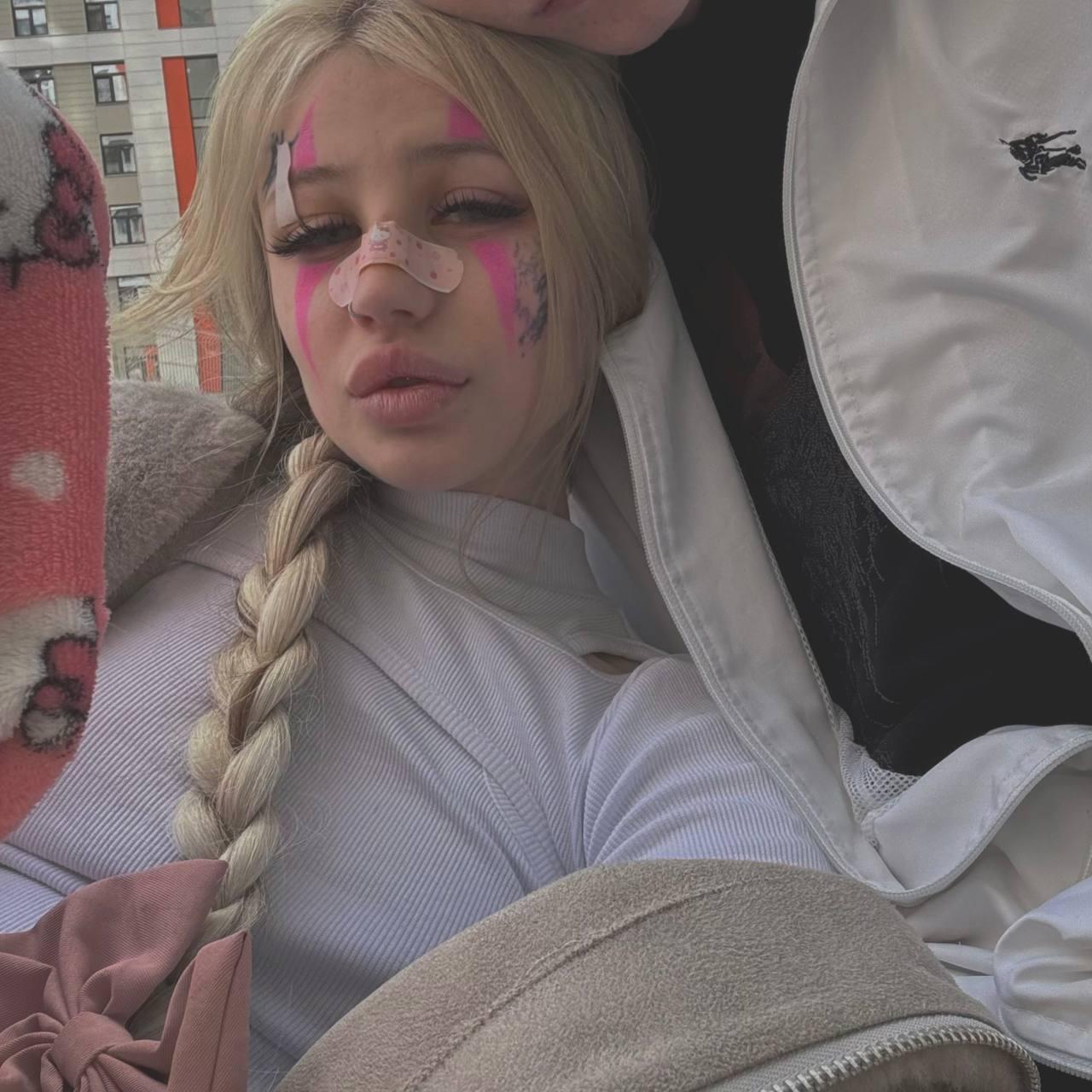 Новая фотка с пластырем на носу. Новая фотка с пластырем на носу.