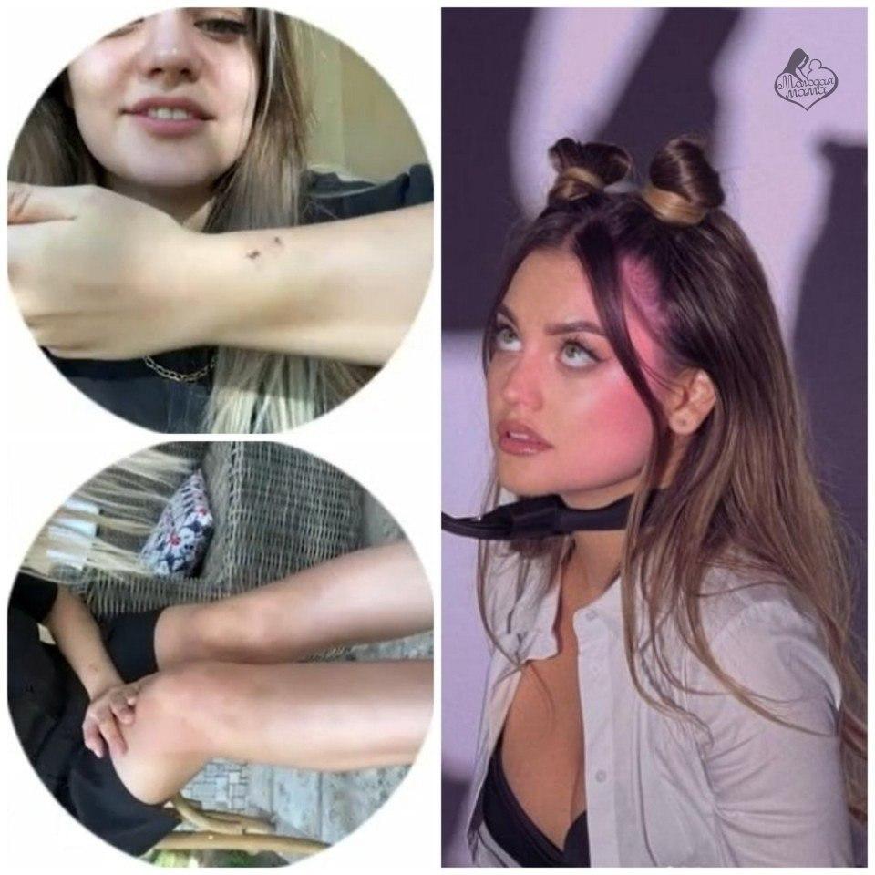 Слитые фото Моргенштерна. Слитые фото Моргенштерна.