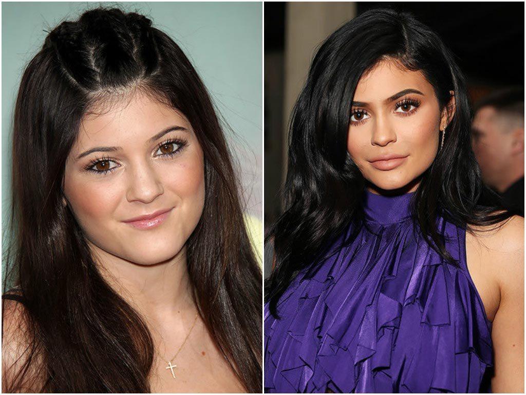 Хостинг картинок yapx.ru