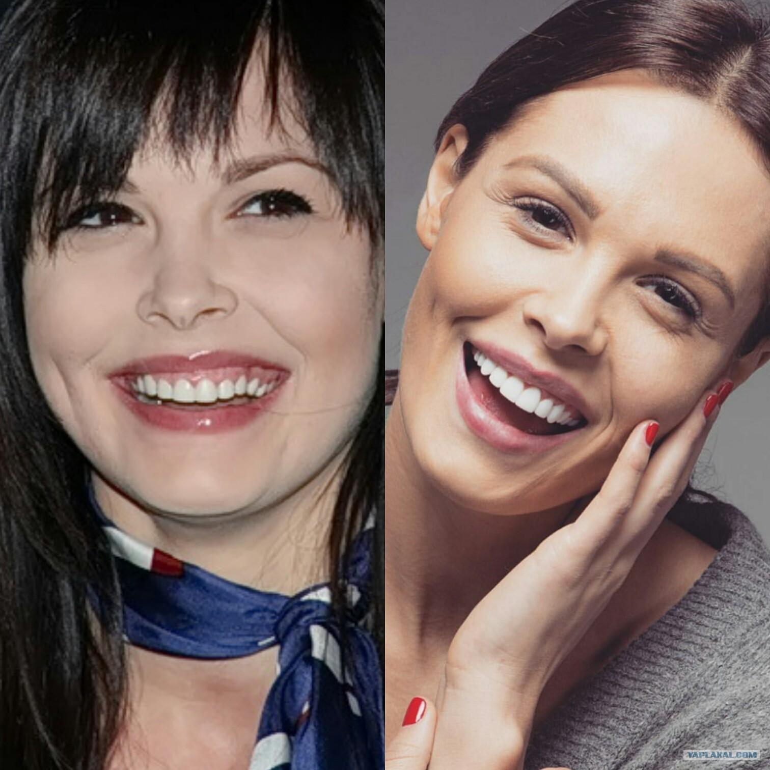 Хостинг картинок yapx.ru