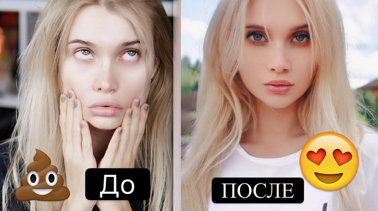 Фото Лиссы Авеми до и после ринопластики. Фото Лиссы Авеми до и после ринопластики.