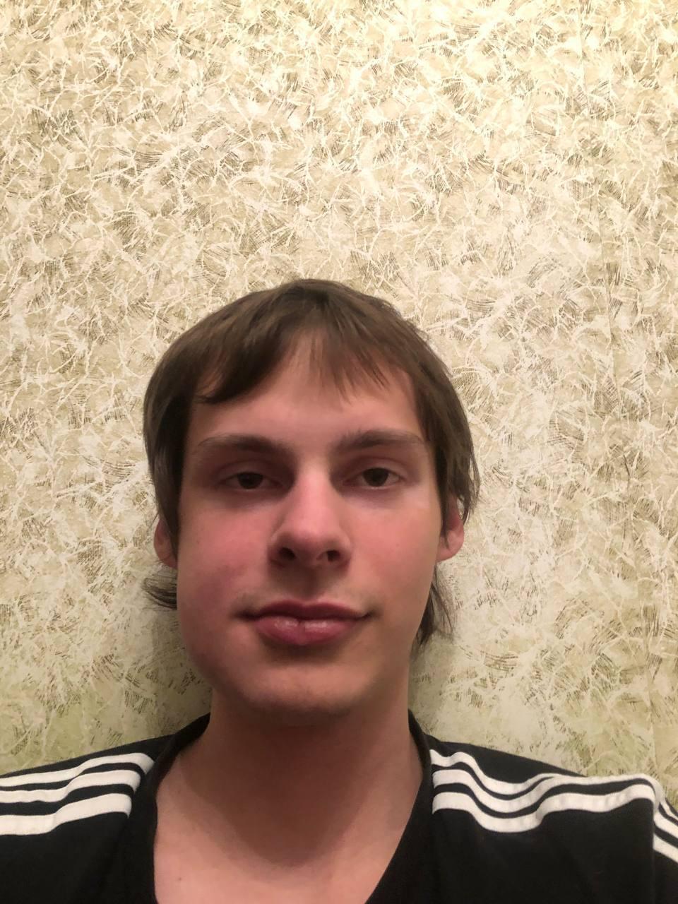 А на этом снимке у нашего героя знатно опухла щека. А на этом снимке у нашего героя знатно опухла щека.