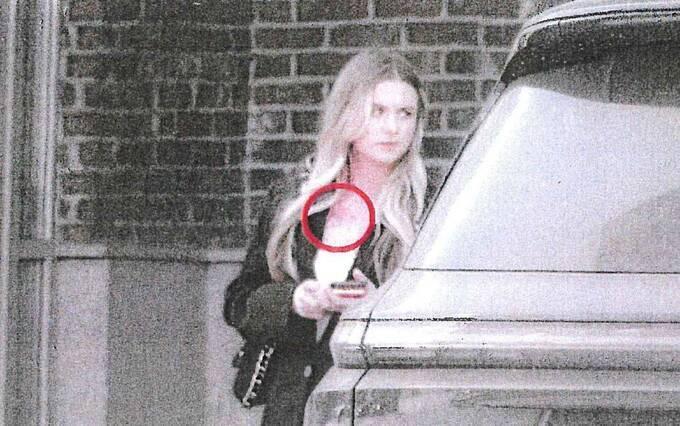 Снимок родинки Дианы. Снимок родинки Дианы.