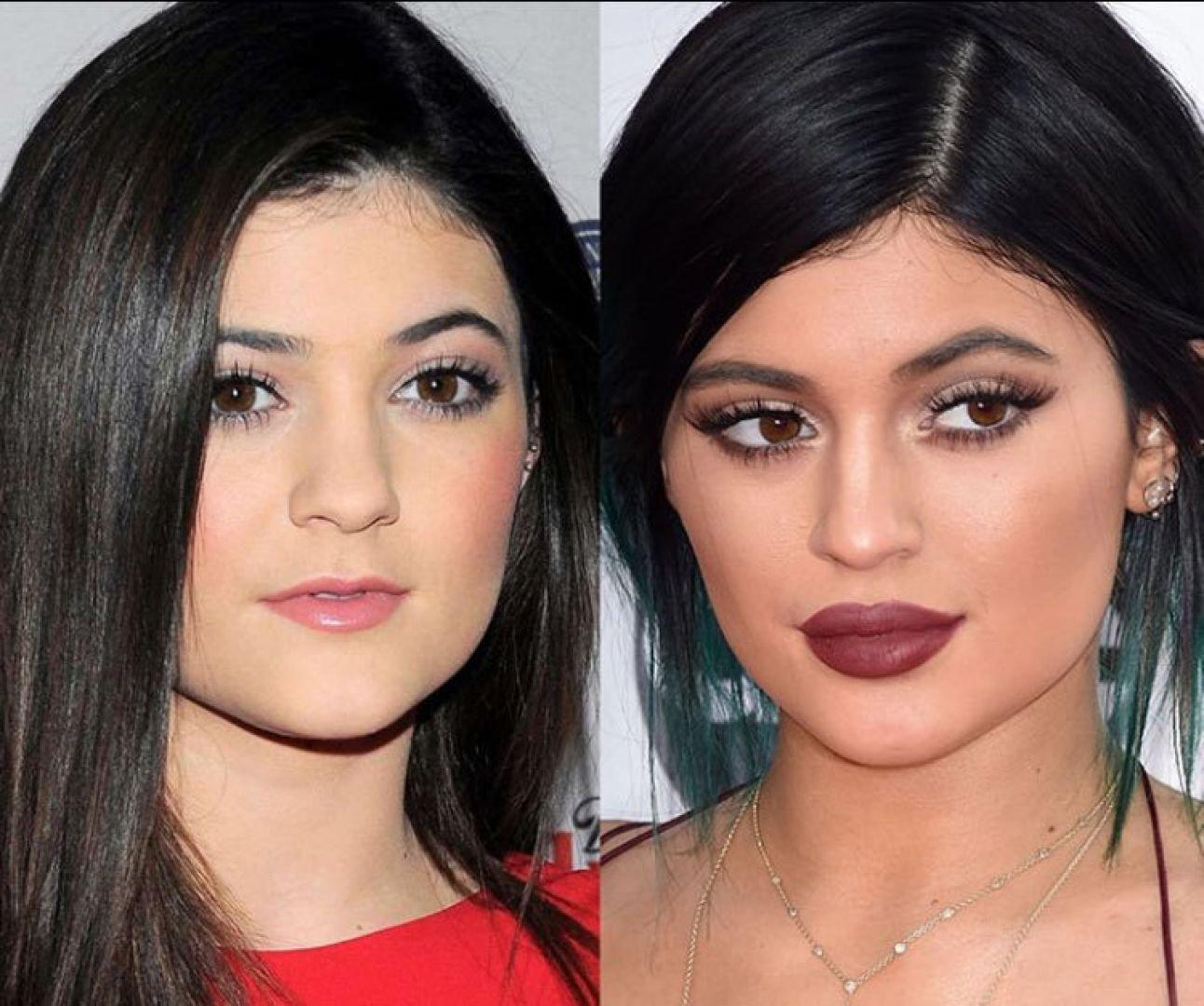 Хостинг картинок yapx.ru