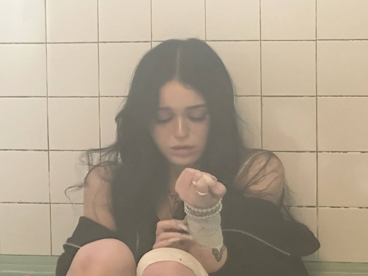 Мутное фото с перебинтованной рукой. Мутное фото с перебинтованной рукой.