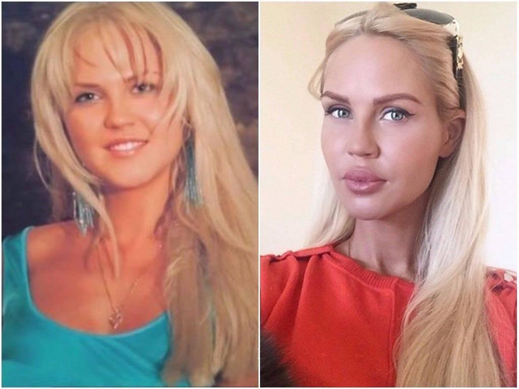 Хостинг картинок yapx.ru