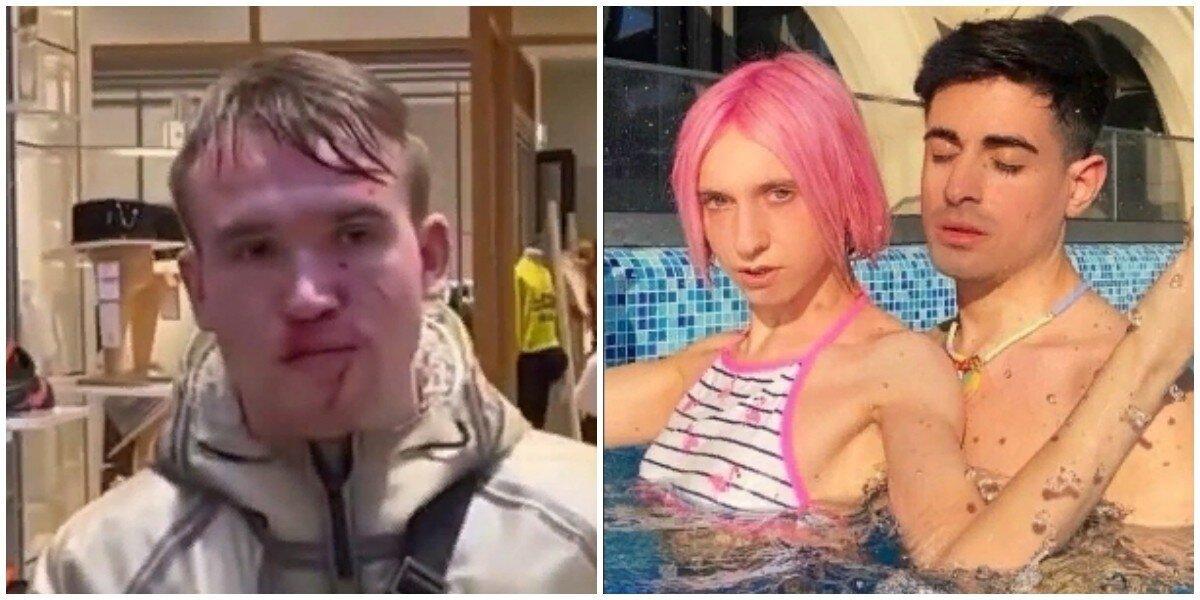 Петушиные бои: спутник Даши Корейки расцарапал лицо парню. Хилми Форкс и Даша корейка.