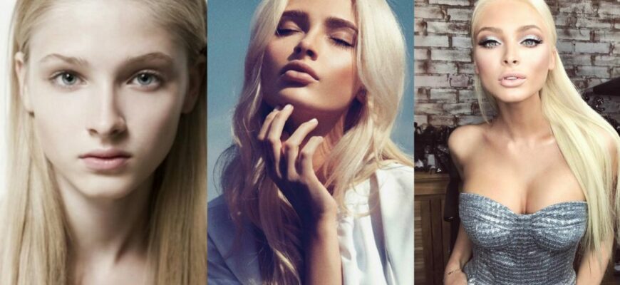 Алёна Шишкова Фото до и после пластики