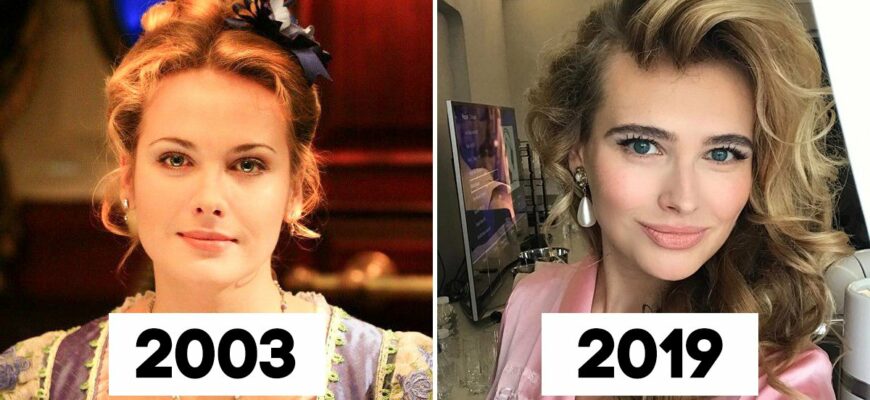 Анна Горшкова до и после пластики (30 фото)