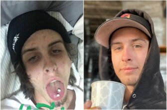 До и после: 40 фото людей, которые решили завязать с наркотиками