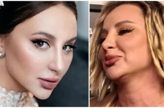 Фото Анна Асти до и после пластики