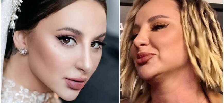 Фото Анна Асти до и после пластики