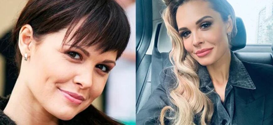 30 Фото Мария Горбань до и после пластики