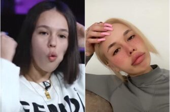 Инстасамка 30 фото До и После Пластики