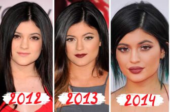 Кайли Дженнер до и после пластики (30 фото)