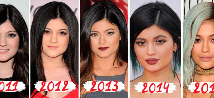 Кайли Дженнер до и после пластики (30 фото)