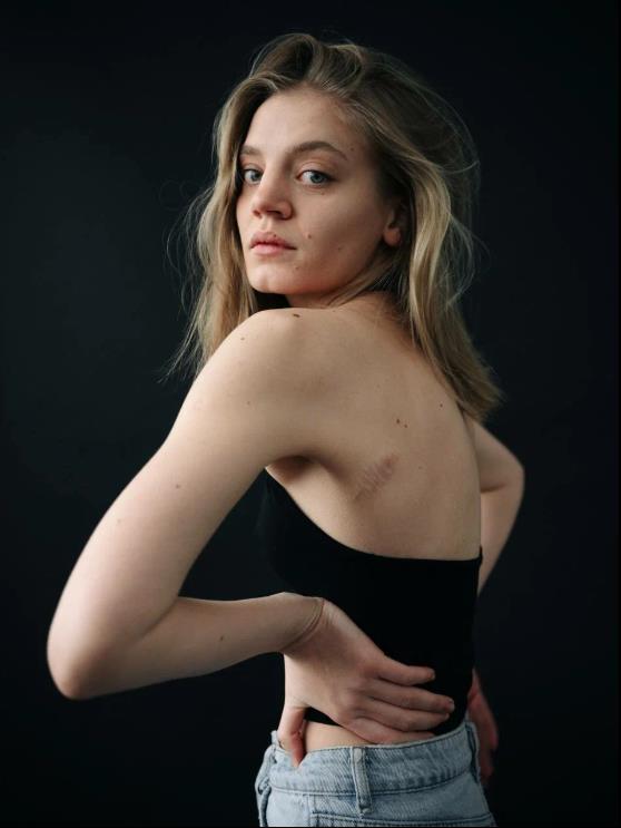 На этом фото Карина Александрова показала фанатам шрам на своей голой спине.